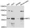 N-Myristoyltransferase 2 antibody, A07621, Boster Biological Technology, Western Blot image 