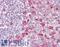 GTase antibody, LS-B8904, Lifespan Biosciences, Immunohistochemistry paraffin image 