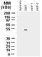 X-Linked Inhibitor Of Apoptosis antibody, TA336331, Origene, Western Blot image 