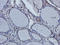 GA Binding Protein Transcription Factor Subunit Beta 1 antibody, orb341193, Biorbyt, Immunohistochemistry paraffin image 