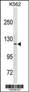 HECT And RLD Domain Containing E3 Ubiquitin Protein Ligase 3 antibody, 60-595, ProSci, Western Blot image 