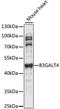 Beta-1,3-Galactosyltransferase 4 antibody, 15-998, ProSci, Western Blot image 