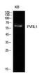 Nectin Cell Adhesion Molecule 1 antibody, A04988, Boster Biological Technology, Western Blot image 