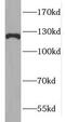 F-Box And Leucine Rich Repeat Protein 13 antibody, FNab03032, FineTest, Western Blot image 