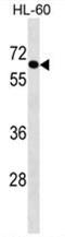 Crystallin Beta-Gamma Domain Containing 2 antibody, AP50125PU-N, Origene, Western Blot image 
