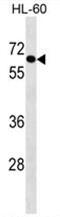 Crystallin Beta-Gamma Domain Containing 2 antibody, AP50125PU-N, Origene, Western Blot image 