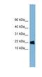 Golgin A7 antibody, NBP1-53153, Novus Biologicals, Western Blot image 