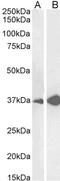 Arginase 1 antibody, PA5-18684, Invitrogen Antibodies, Western Blot image 
