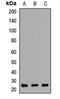 RAB27B, Member RAS Oncogene Family antibody, LS-C667996, Lifespan Biosciences, Western Blot image 