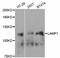 Lysosomal Associated Membrane Protein 1 antibody, STJ24368, St John