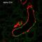 Sodium Channel Epithelial 1 Beta Subunit antibody, NBP2-59382, Novus Biologicals, Immunohistochemistry paraffin image 