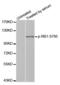 RB Transcriptional Corepressor 1 antibody, abx000226, Abbexa, Western Blot image 