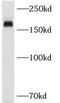 MMR antibody, FNab09912, FineTest, Western Blot image 