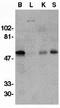 GDNF Family Receptor Alpha 1 antibody, GTX11115, GeneTex, Western Blot image 