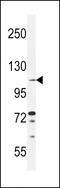 Tolloid Like 2 antibody, 55-779, ProSci, Western Blot image 