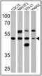 Peroxisome Proliferator Activated Receptor Alpha antibody, NB120-3484, Novus Biologicals, Western Blot image 