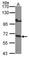 Interleukin 10 Receptor Subunit Alpha antibody, PA5-27772, Invitrogen Antibodies, Western Blot image 