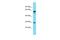 Family With Sequence Similarity 110 Member D antibody, A17937, Boster Biological Technology, Western Blot image 