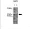 Nuclear RNA Export Factor 1 antibody, NBP1-57160, Novus Biologicals, Western Blot image 
