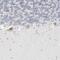 TRNA Splicing Endonuclease Subunit 2 antibody, PA5-55562, Invitrogen Antibodies, Immunohistochemistry paraffin image 