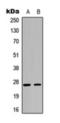 Cyclin Dependent Kinase Inhibitor 1B antibody, orb393240, Biorbyt, Western Blot image 