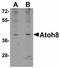 Atonal BHLH Transcription Factor 8 antibody, LS-C108489, Lifespan Biosciences, Western Blot image 