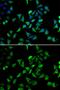 Eukaryotic Translation Initiation Factor 3 Subunit C antibody, GTX65854, GeneTex, Immunocytochemistry image 