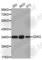 Cyclin Dependent Kinase 2 antibody, A5525, ABclonal Technology, Western Blot image 