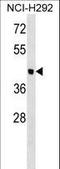 Otolin 1 antibody, LS-C163285, Lifespan Biosciences, Western Blot image 