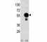 AKT Serine/Threonine Kinase 2 antibody, F50040-0.4ML, NSJ Bioreagents, Western Blot image 