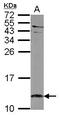 C-X-C Motif Chemokine Ligand 12 antibody, PA5-30603, Invitrogen Antibodies, Western Blot image 