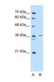 Tropomyosin 2 antibody, NBP1-57612, Novus Biologicals, Western Blot image 