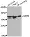 Annexin A2 antibody, LS-C747503, Lifespan Biosciences, Western Blot image 