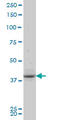 PBK/TOPK antibody, LS-C176446, Lifespan Biosciences, Western Blot image 