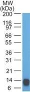 Epidermal Growth Factor Receptor Pathway Substrate 8 antibody, NBP2-27344, Novus Biologicals, Western Blot image 