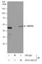 Histone methyltransferase SMYD2 antibody, GTX116510, GeneTex, Immunoprecipitation image 