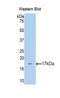 Vanin 1 antibody, LS-C296937, Lifespan Biosciences, Western Blot image 