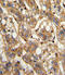 Interferon Beta 1 antibody, LS-C165130, Lifespan Biosciences, Immunohistochemistry paraffin image 