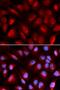 DnaJ Heat Shock Protein Family (Hsp40) Member B1 antibody, orb167408, Biorbyt, Immunocytochemistry image 
