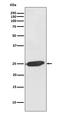 Synaptosome Associated Protein 25 antibody, M01625, Boster Biological Technology, Western Blot image 