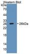 Interleukin 27 Receptor Subunit Alpha antibody, LS-C685559, Lifespan Biosciences, Western Blot image 