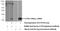 Interleukin 36 Receptor Antagonist antibody, 13113-1-AP, Proteintech Group, Western Blot image 