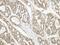 Phosphatidylinositol-5-Phosphate 4-Kinase Type 2 Alpha antibody, PA5-28435, Invitrogen Antibodies, Immunohistochemistry frozen image 