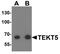 Tektin 5 antibody, A16234, Boster Biological Technology, Western Blot image 