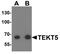 Tektin-5 antibody, A16234, Boster Biological Technology, Western Blot image 