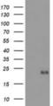 Ephrin A2 antibody, NBP2-02810, Novus Biologicals, Western Blot image 