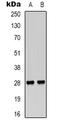 TNF Superfamily Member 15 antibody, orb339162, Biorbyt, Western Blot image 