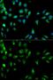 Ras association domain-containing protein 1 antibody, GTX54696, GeneTex, Immunofluorescence image 