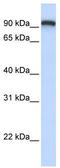 Transmembrane Protein 168 antibody, TA338609, Origene, Western Blot image 