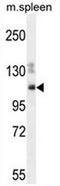 Spectrin Repeat Containing Nuclear Envelope Family Member 3 antibody, AP54124PU-N, Origene, Western Blot image 